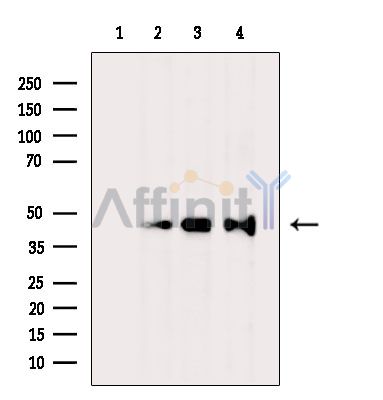 NT Antibody - Western blot analysis of extracts from various samples, using NT Antibody.