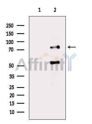PHACTR4 Antibody - Western blot analysis of extracts from Rat liver, using PHACTR4 Antibody.