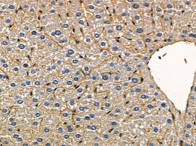 G3BP2 Antibody - DF4387 at 1/100 staining mouse liver tissue by IHC-P.