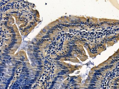 RAB31 Antibody - DF4401 at 1/100 staining rat colorectal tissue by IHC-P.