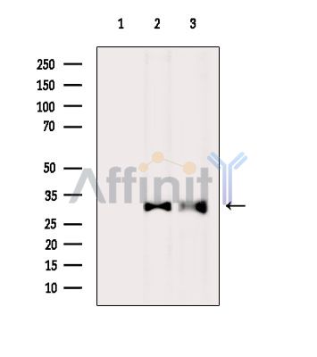 SCAMP1 Antibody - Western blot analysis of extracts from various samples, using SCAMP1 Antibody.