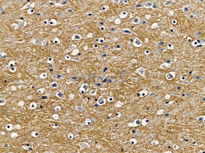 SCAMP1 Antibody - DF4453 at 1/100 staining mouse brain tissue by IHC-P.