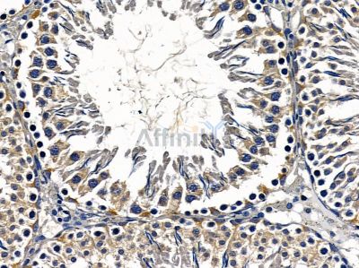 SHANK2 Antibody - DF4501 at 1/100 staining rat testis tissue by IHC-P.
