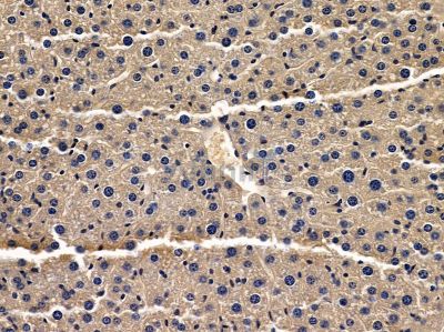 SNX3 Antibody - DF4537 at 1/100 staining mouse liver tissue by IHC-P.