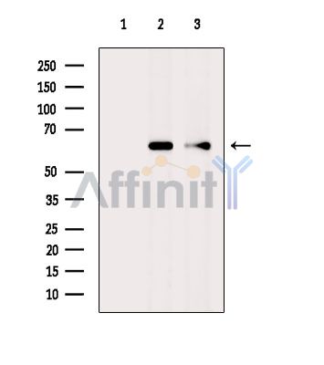 Cytochrome P450 4F11 Antibody - Western blot analysis of extracts from various samples, using Cytochrome P450 4F11 Antibody.