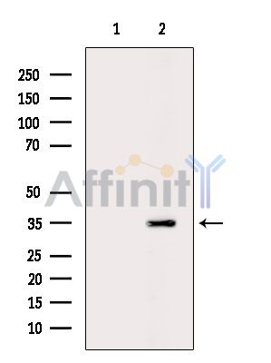 OR51A2 Antibody - Western blot analysis of extracts from Rat liver, using OR51A2 Antibody.