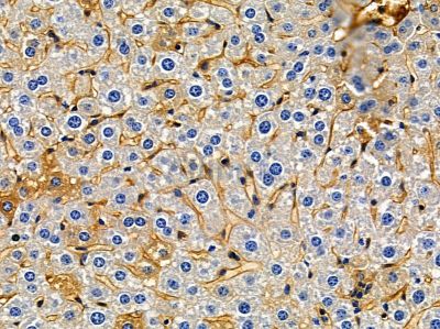 OR10G7 Antibody - DF5180 at 1/100 staining mouse liver tissue by IHC-P.