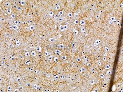 OR10G7 Antibody - DF5180 at 1/100 staining mouse brain tissue by IHC-P.