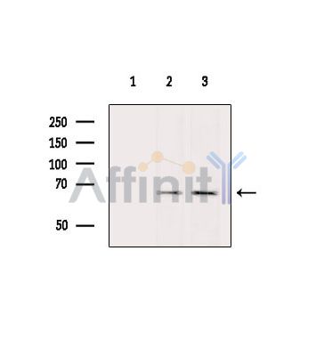 NOX4 Antibody - Western blot analysis of extracts from various samples, using NOX4 Antibody.