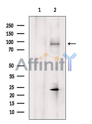 PARP1 Antibody - Western blot analysis of extracts from Hela cells, using PARP1 Antibody.