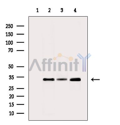 CBR1 Antibody - Western blot analysis of extracts from various samples, using CBR1 Antibody.