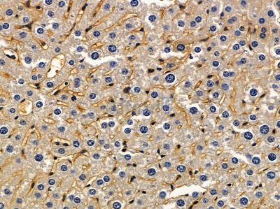 TRIP10 Antibody - DF8087 at 1/100 staining mouse liver tissue by IHC-P.