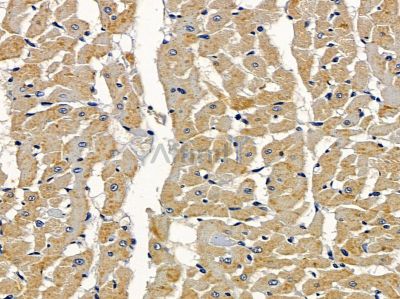 TRIP10 Antibody - DF8087 at 1/100 staining rat heart tissue by IHC-P.