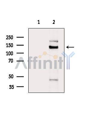 TIMELESS Antibody - Western blot analysis of extracts from Hela cells(heat-shock treatment), using TIMELESS Antibody.