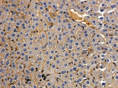 TCR beta Antibody - DF8621 at 1/100 staining mouse liver tissue by IHC-P.
