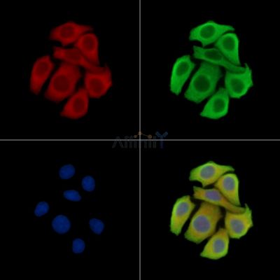 TCR beta Antibody - DF8621 staining Hela cells by IF/ICC.