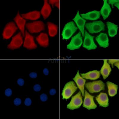 TCR beta Antibody - DF8621 staining Hela cells by IF/ICC.