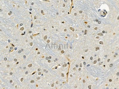 NIP7 Antibody - DF9138 at 1/100 staining rat brain tissue by IHC-P.