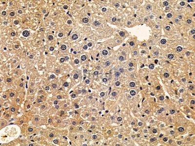 ACBD4 Antibody - DF9151 at 1/100 staining mouse liver tissue by IHC-P.