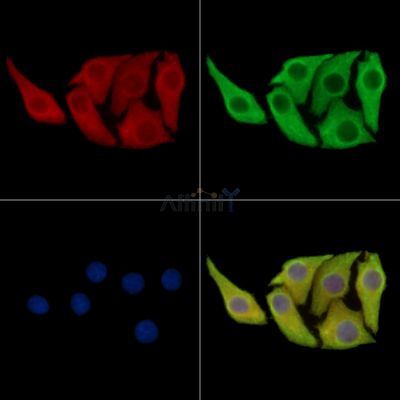 ACBD4 Antibody - DF9151 staining Hela cells by IF/ICC.