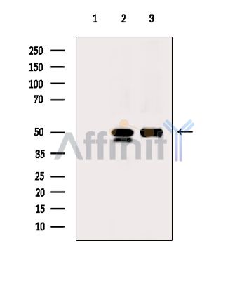 ACOT9 Antibody - Western blot analysis of extracts from various samples, using ACOT9 Antibody.