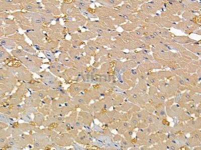 ACOT9 Antibody - DF9157 at 1/100 staining rat heart tissue by IHC-P.