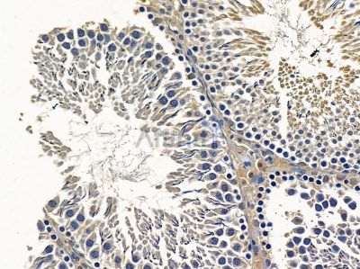 ALS2CR16 Antibody - DF9205 at 1/100 staining rat testis tissue by IHC-P.