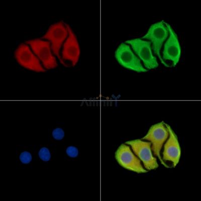ALS2CR16 Antibody - DF9205 staining Hela cells by IF/ICC.