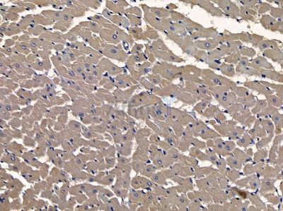 AMOT Antibody - DF9208 at 1/100 staining rat heart tissue by IHC-P.