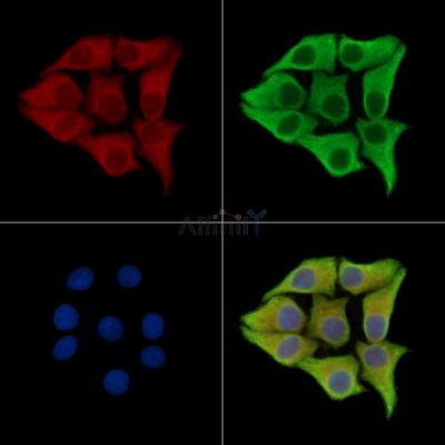 AMOT Antibody - DF9208 staining Hela cells by IF/ICC.