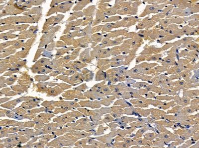 SLC4A3 Antibody - DF9213 at 1/100 staining rat heart tissue by IHC-P.