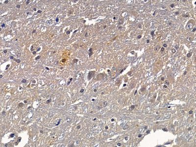 BCAS3 Antibody - DF9291 at 1/100 staining rat brain tissue by IHC-P.