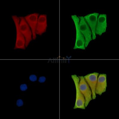 CST6 Antibody - DF9426 staining Hela cells by IF/ICC.