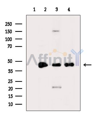 HOXD11 Antibody - Western blot analysis of extracts from various samples, using HOXD11 Antibody.