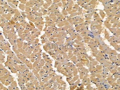 MYO1B Antibody - DF9651 at 1/100 staining rat heart tissue by IHC-P.