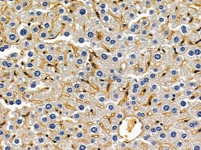 NLGN2 Antibody - DF9691 at 1/100 staining mouse liver tissue by IHC-P.