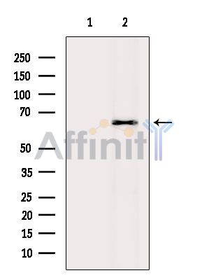 AMPK alpha Antibody - Western blot analysis of extracts from Rat heart, using AMPK alpha Antibody.