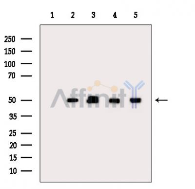 Tubulin alpha Antibody - Western blot analysis of extracts from various samples, using Tubulin alpha Antibody.