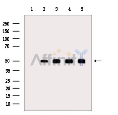 Tubulin alpha Antibody - Western blot analysis of extracts from various samples, using Tubulin alpha Antibody.