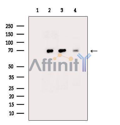 HCRTR1 Mouse Monoclonal Antibody - Western blot analysis of extracts from various samples, using HCRTR1 Mouse Monoclonal Antibody.