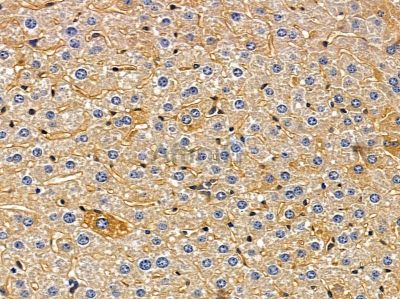 GPR182 Antibody - DF10215 at 1/100 staining mouse liver tissue by IHC-P.