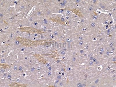 GPR179 Antibody - DF10219 at 1/100 staining rat brain tissue by IHC-P.