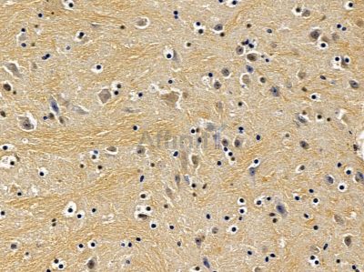 XPO6 Antibody - DF12799 at 1/100 staining mouse brain tissue by IHC-P.