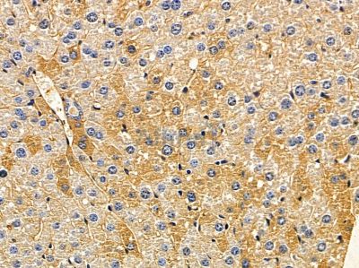 ARMC10 Antibody - DF12835 at 1/100 staining mouse liver tissue by IHC-P.