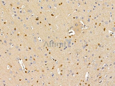 ASPA Antibody - DF12841 at 1/100 staining rat brain tissue by IHC-P.