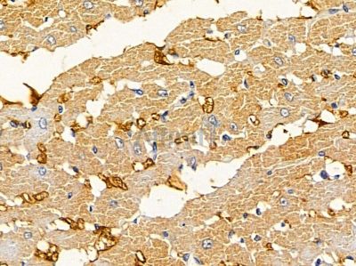 CDR2 Antibody - DF12892 at 1/100 staining rat heart tissue by IHC-P.