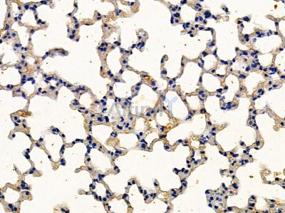 DIO2 Antibody - DF12941 at 1/100 staining mouse lung tissue by IHC-P.