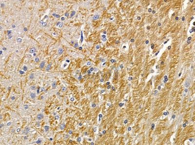 DNAJC21 Antibody - DF12950 at 1/100 staining rat brain tissue by IHC-P.