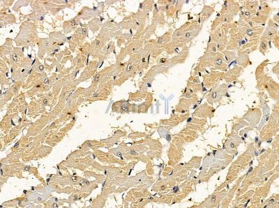 DOCK8 Antibody - DF12957 at 1/100 staining rat heart tissue by IHC-P.