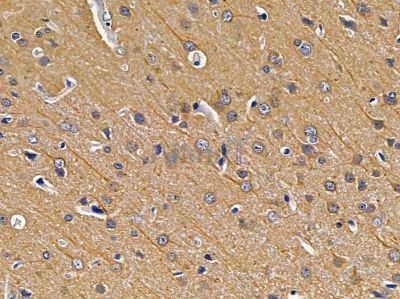 EXOSC10 Antibody - DF12990 at 1/100 staining rat brain tissue by IHC-P.